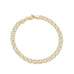Link by Link Bracelet